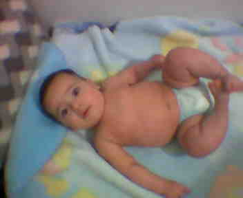 ililase
